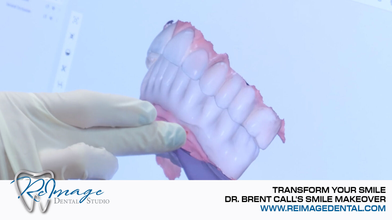 Smile Makeover | ReImage Dental Studio | Scottsdale Dentist Dr. Brent Call