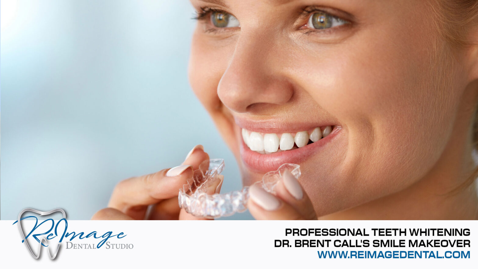 Professional Teeth Whitening | Scottsdale Dentist