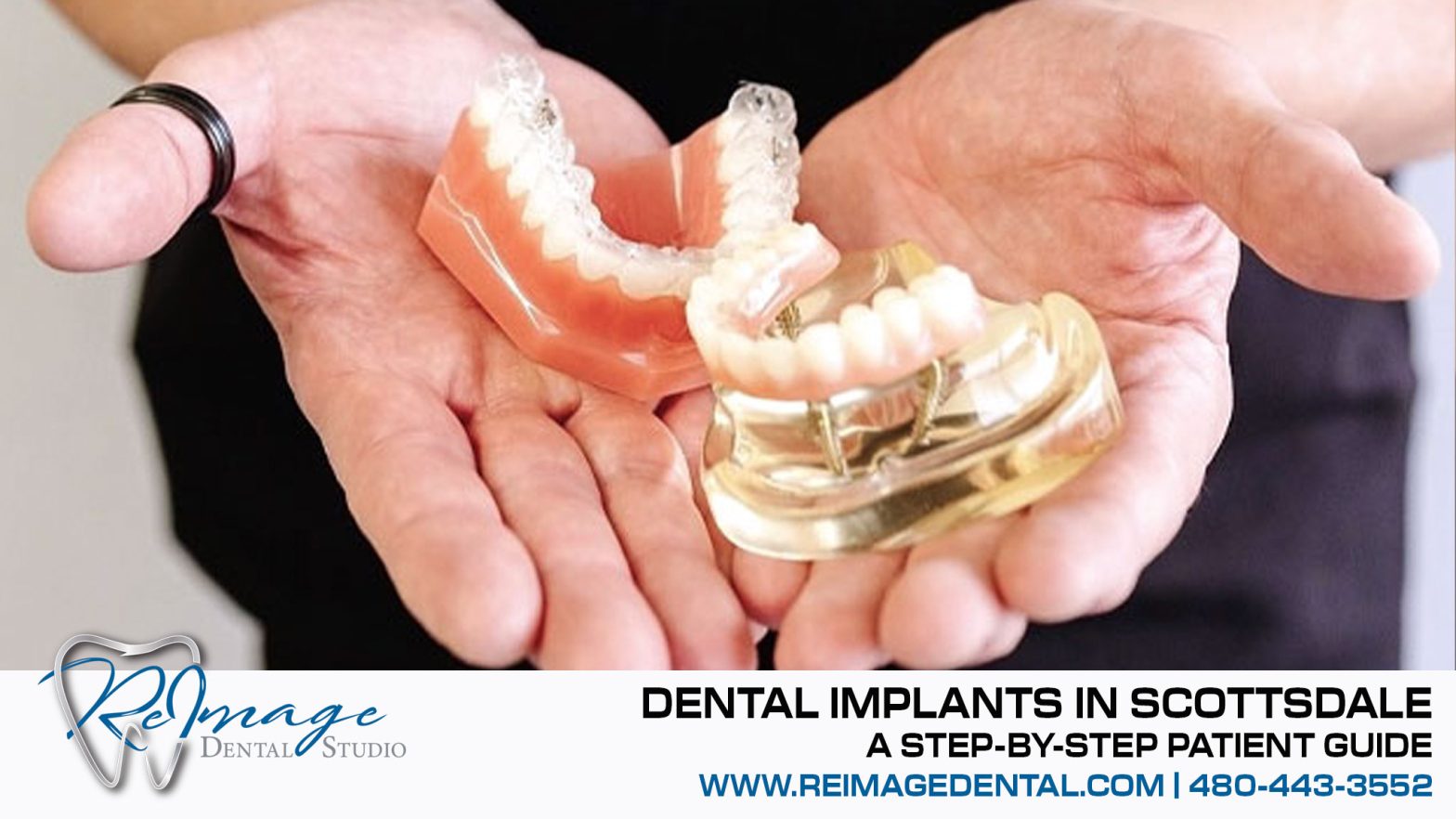 Dental Implants In Scottsdale | ReImage Dental Studio
