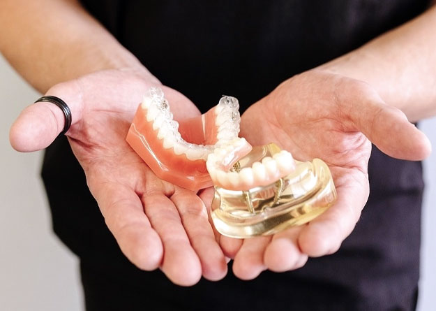 Dental Implants | ReImage Dental Studio | Scottsdale Dentist Dental Implants | ReImage Dental Studio | Scottsdale Dentist