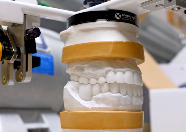 Dental Implants | ReImage Dental Studio | Scottsdale Dentist Dental Implants | ReImage Dental Studio | Scottsdale Dentist